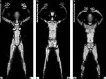 Immature: A former TSA officer has revealed that he had witnessed his co-workers laughing at the nude X-ray images of passengers going through full-body scanners 