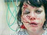 Loretta Butterworth was left with horrific facial injuries after her boyfriend, Toby Hayden, beat her up