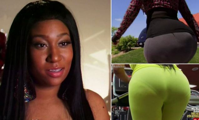 Woman Addicted To Injections That Make Her Butt Bigger