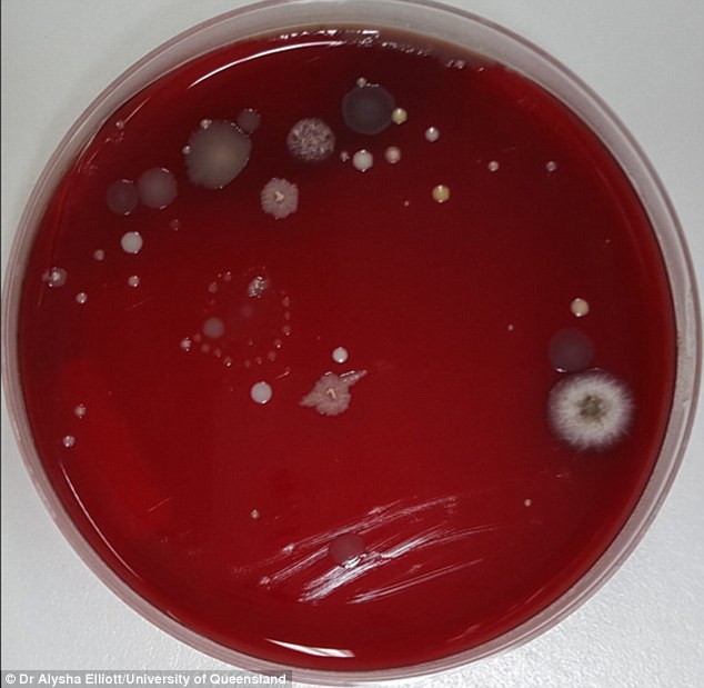 Photos show the amount of bacteria on your ha